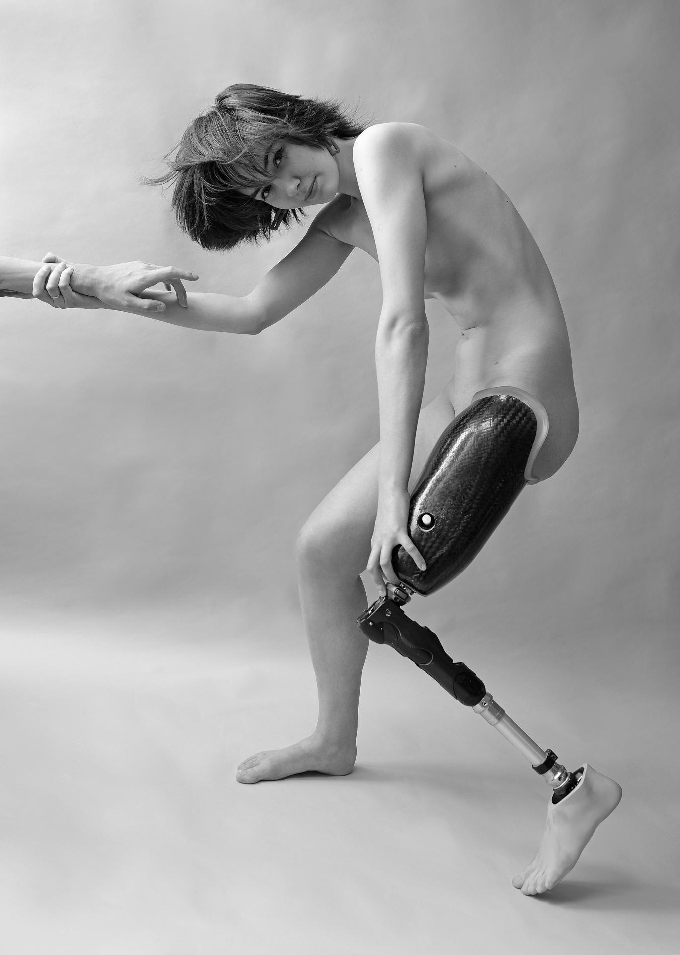 London Photography Awards Winner - Life On A Prosthesis.