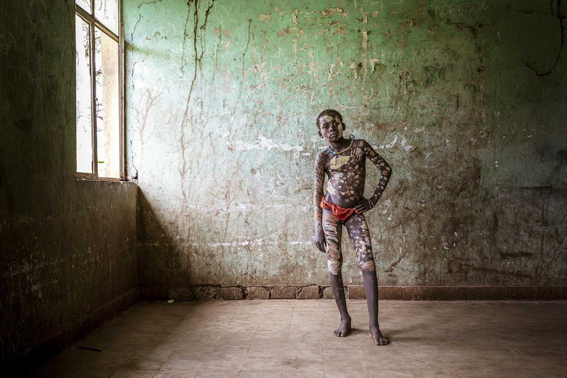 London Photography Awards Winner - Between Milk and Blood